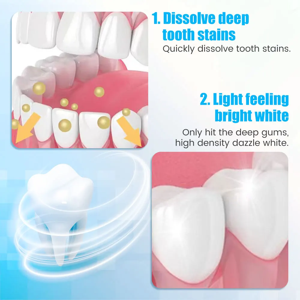 9D Teeth Whitening Stickers Mi - Teeth Whitening Yellow Teeth recensione e prezzo