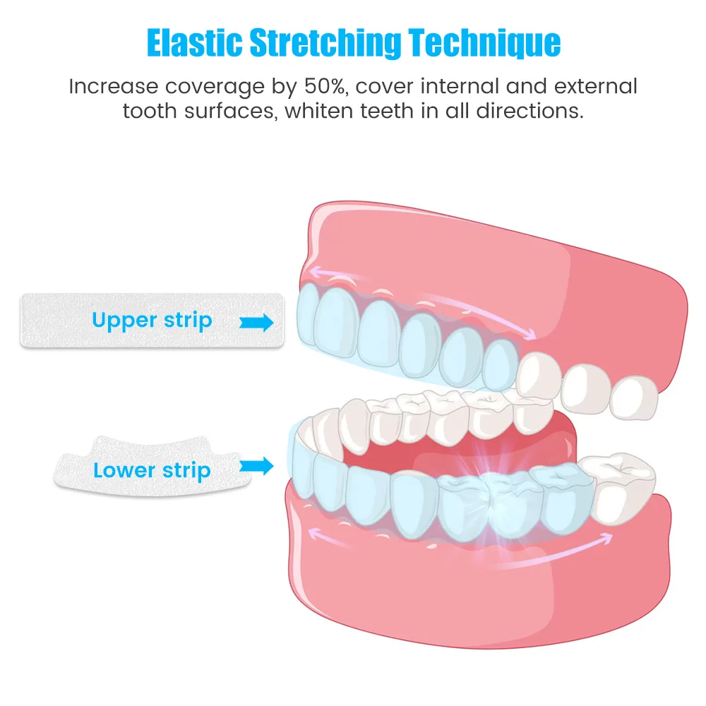 9D Teeth Whitening Stickers Mi - Teeth Whitening Yellow Teeth recensione e prezzo