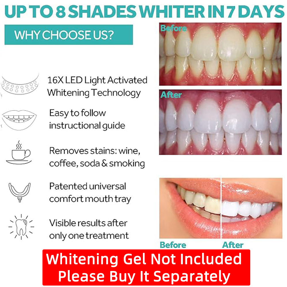 Vaclav Teeth Whitening Light K - Led Mouth Tray recensione e prezzo