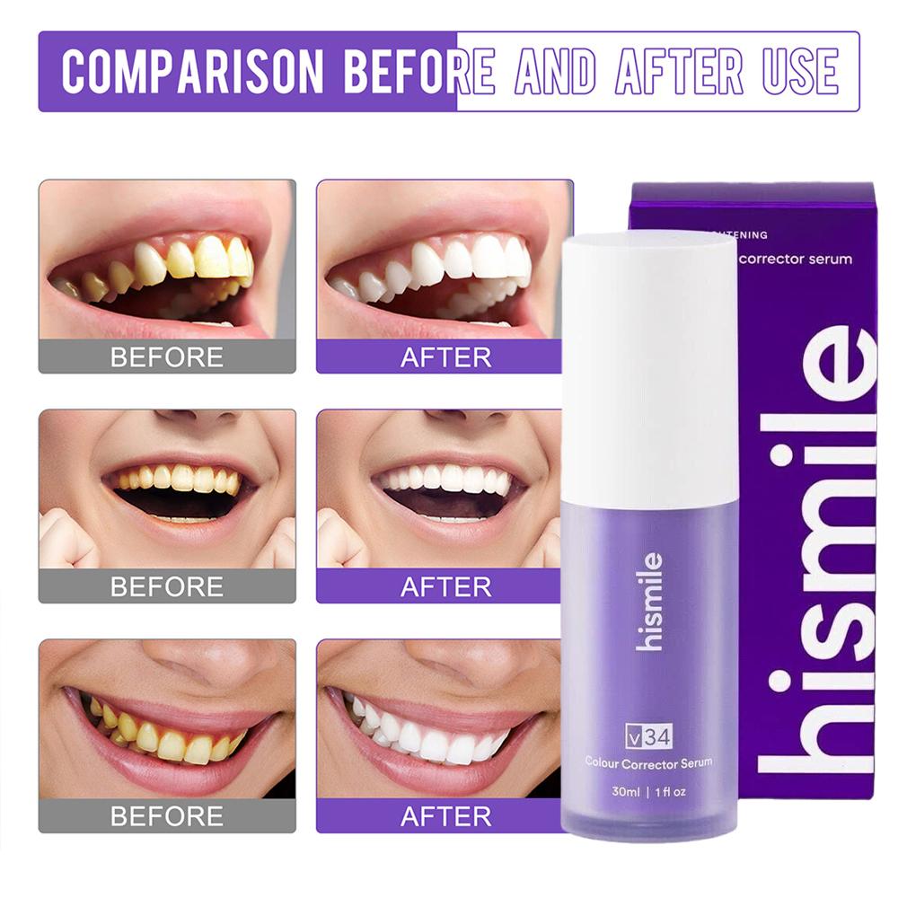 30ml Hismile V34 Purple Teeth  - Teeth Whitening Hismile recensione e prezzo