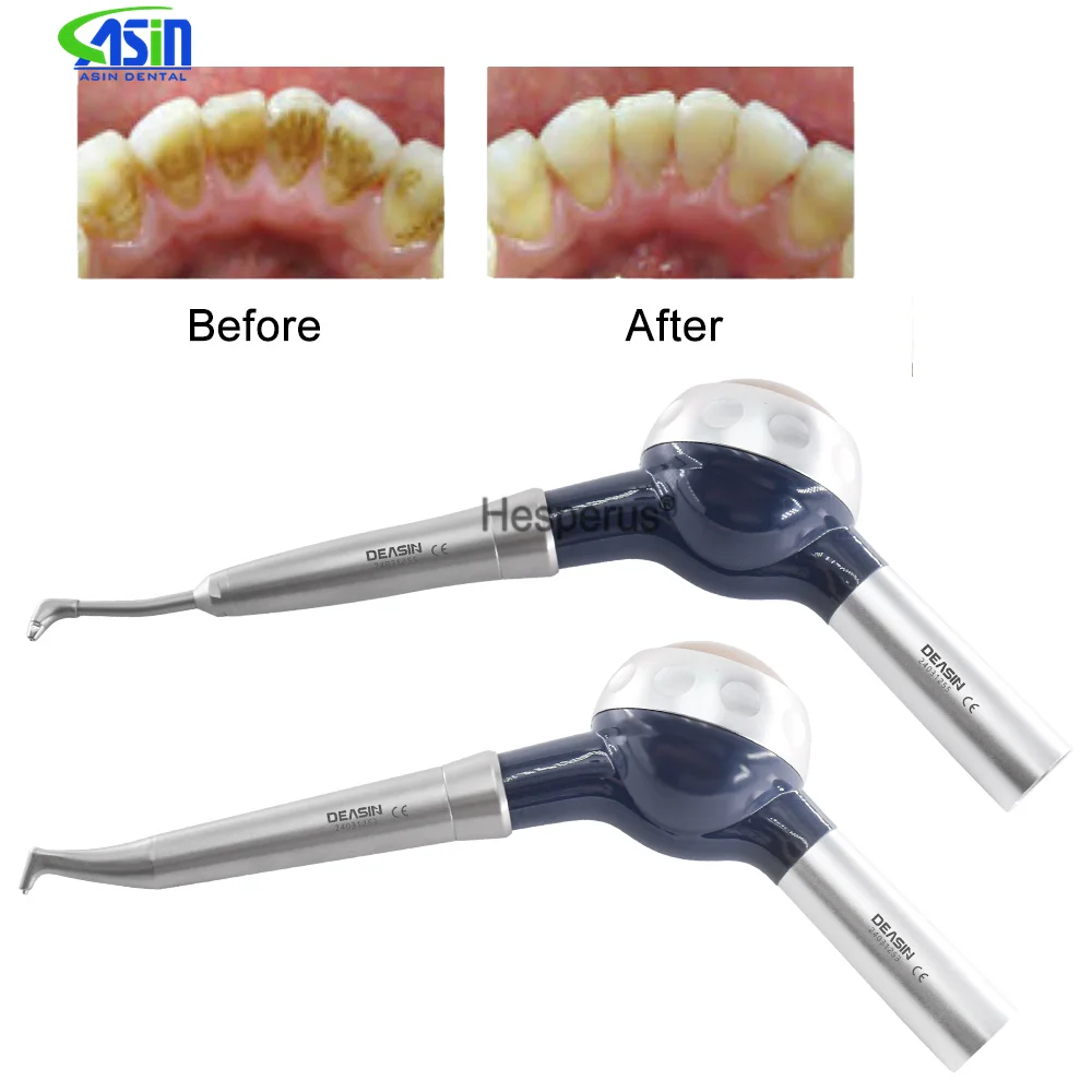 Teeth Whitening Spray Dental A - Colgate Whitening Teeth recensione e prezzo