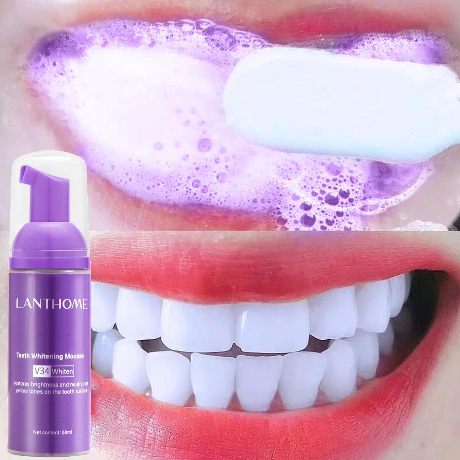V34 Mousse Teeth Cleaning Toot - Teeth Whitening Yellow Teeth recensione e prezzo