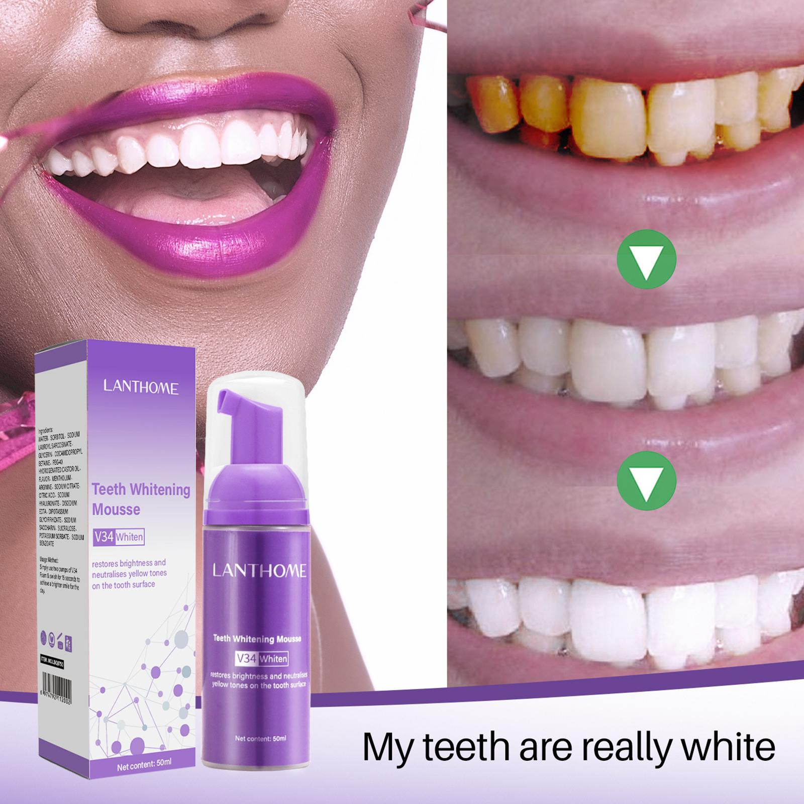 V34 Mousse Teeth Cleaning Toot - Teeth Whitening Yellow Teeth recensione e prezzo