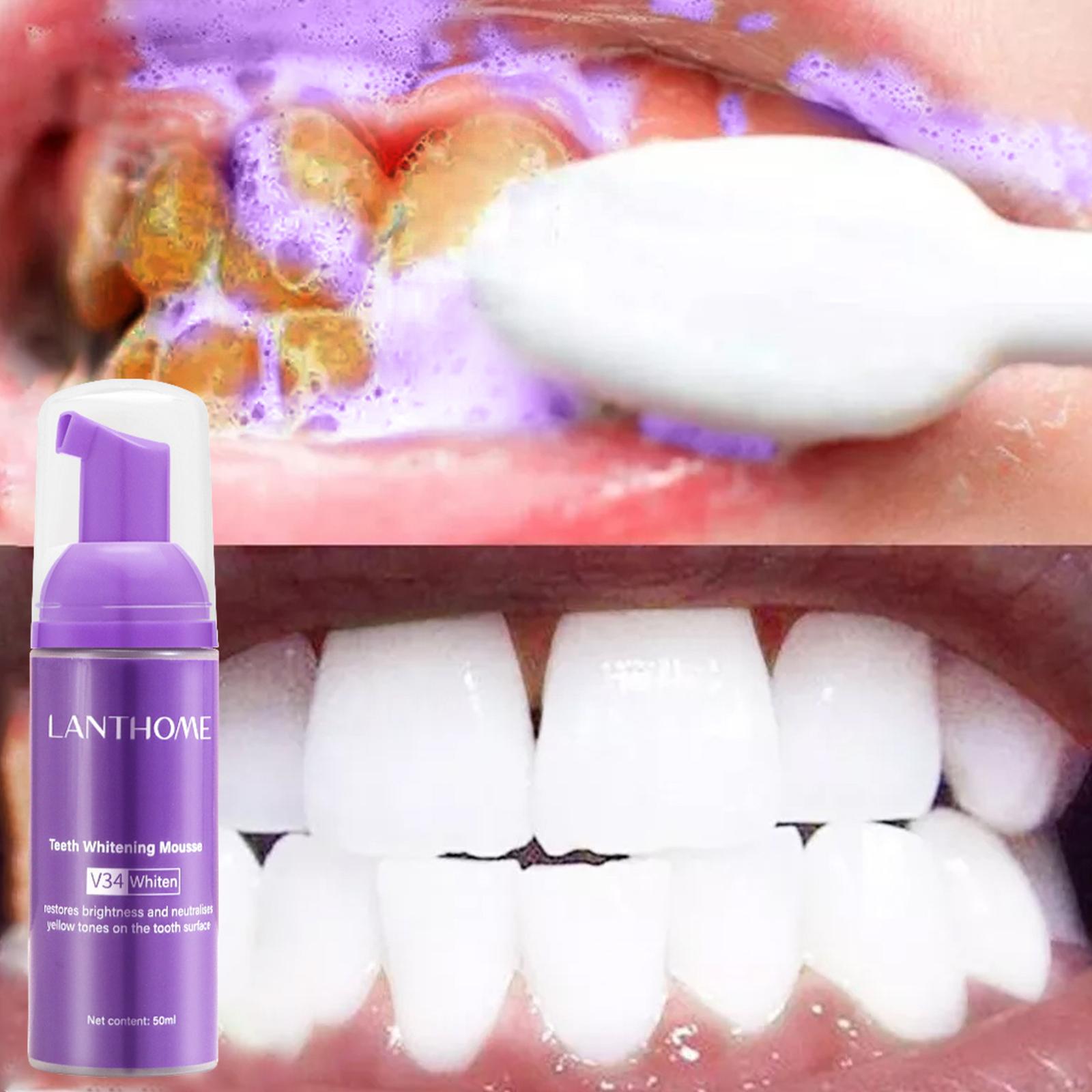 V34 Mousse Teeth Cleaning Toot - Teeth Whitening Yellow Teeth recensione e prezzo