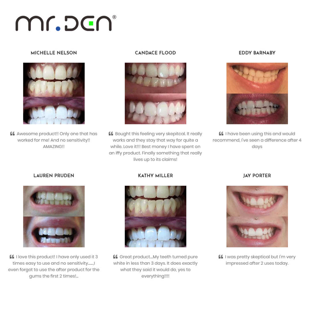Dr. Whiten 3 Pack Teeth Whiten - Teeth Whitening Gels recensione e prezzo