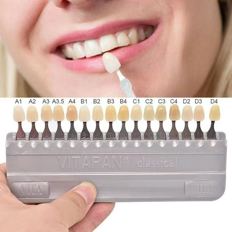 VITA 16 Colors Teeth Shade Gui - Whitening Teeth Dentist recensione e prezzo