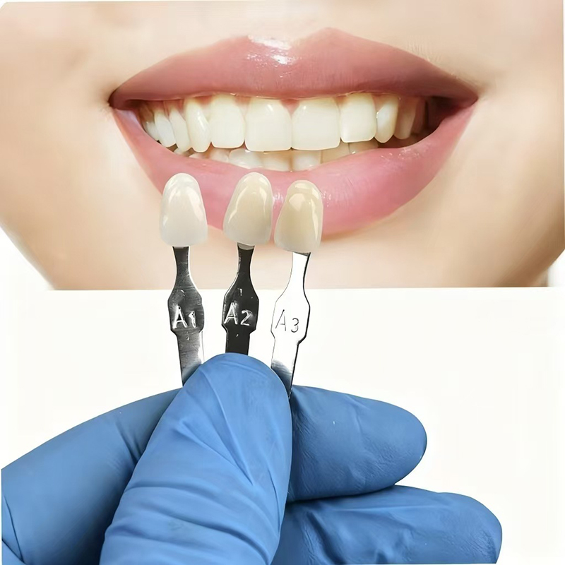 VITA 16 Colors Teeth Shade Gui - Whitening Teeth Dentist recensione e prezzo