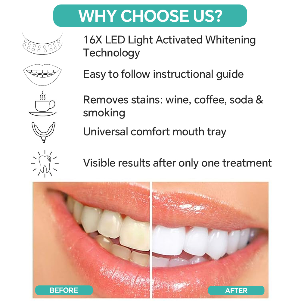 Teeth Whitening Accelerator Li - Teeth Whitening/Bleaching recensione e prezzo