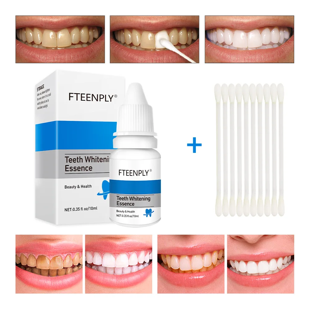 FTEENPLY Teeth Whitening Essen - Teeth Whitening/Bleaching recensione e prezzo
