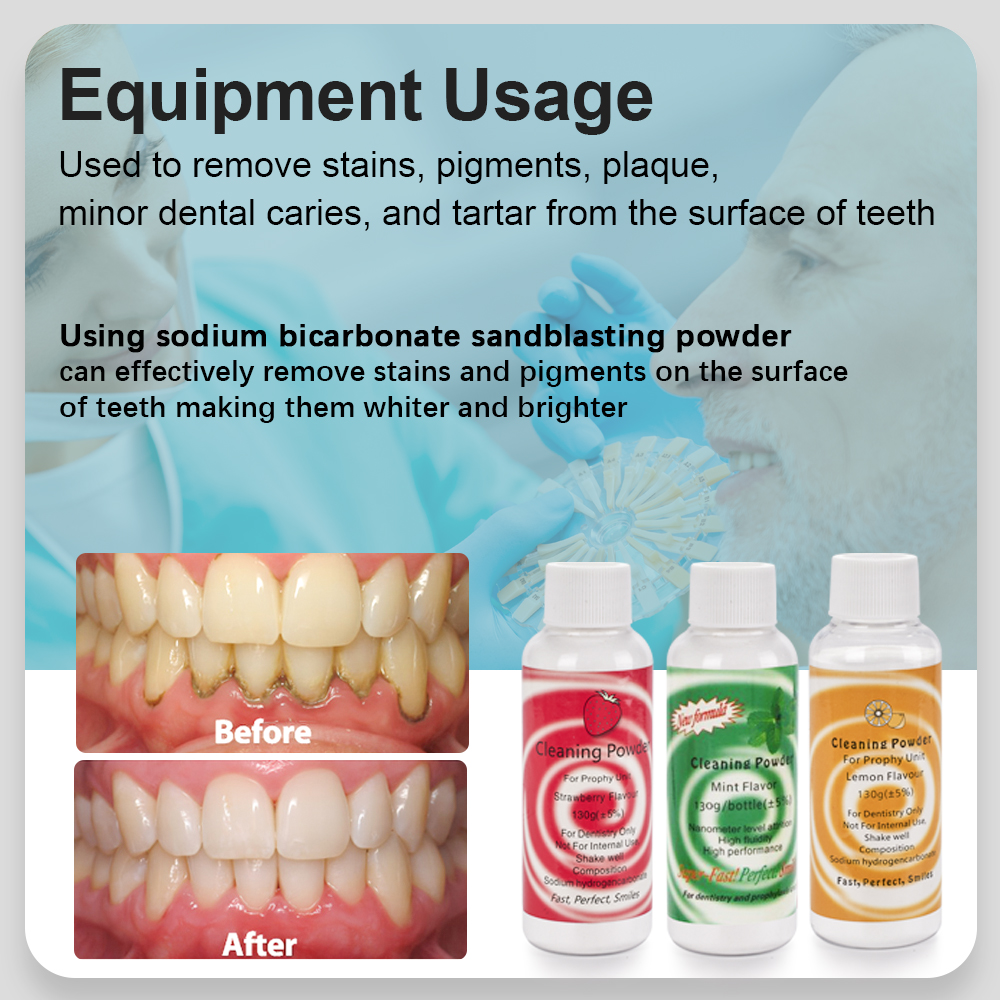 Dental equipment Teeth Whiteni - Colgate Whitening Teeth recensione e prezzo