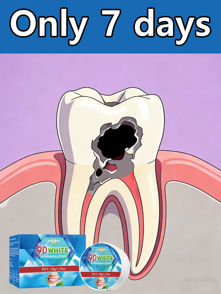 Whitening toothpaste and miner - Teeth Whitening Effects recensione e prezzo