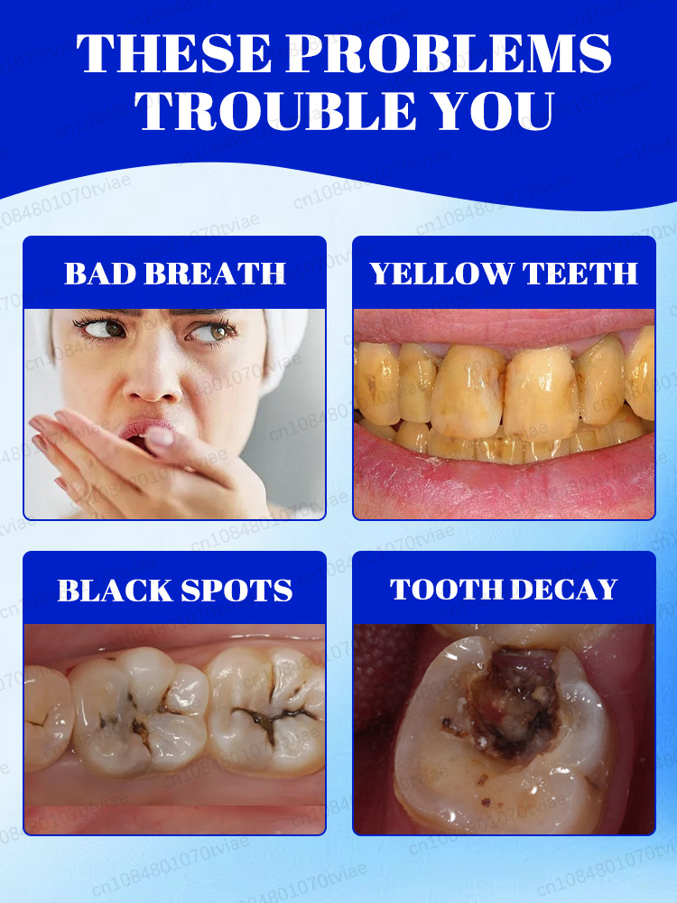 Whitening toothpaste and miner - Teeth Whitening Effects recensione e prezzo