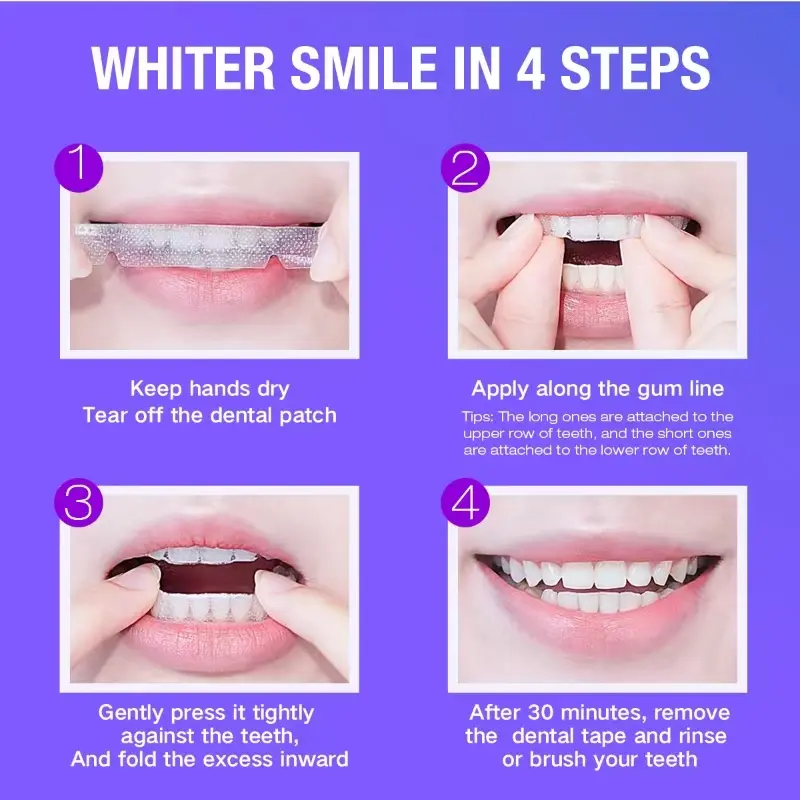 Teeth Whitening Kit - 5X LED L - Teeth Whitening Strips recensione e prezzo