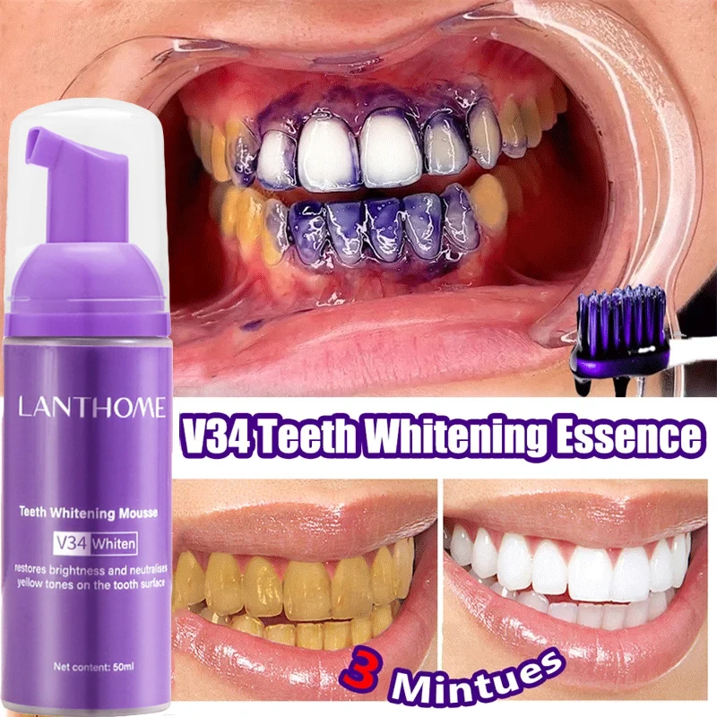 V34 Teeth Whitening Mousse Too - Teeth Whitening/Bleaching recensione e prezzo