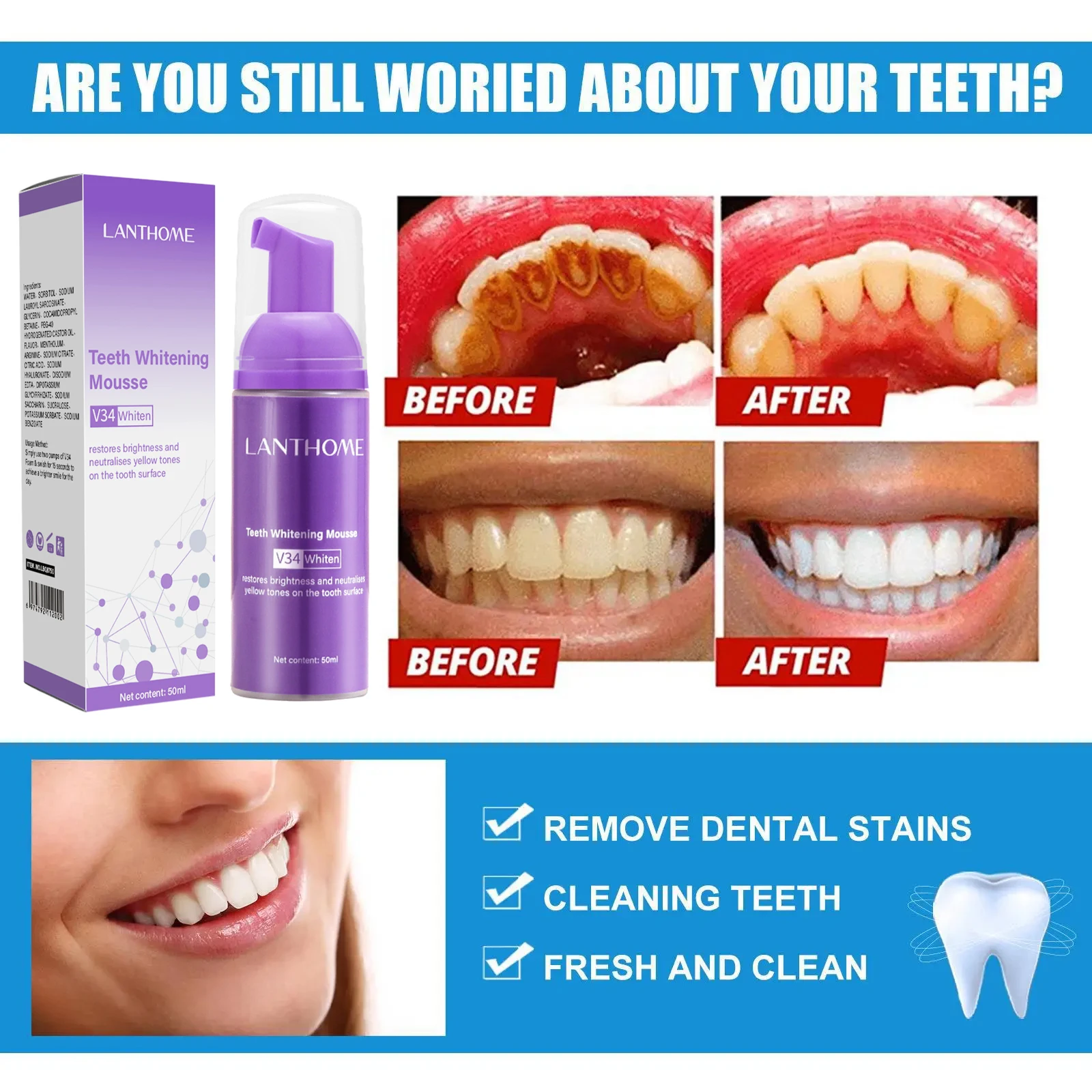 V34 Teeth Whitening Mousse Too - Teeth Whitening/Bleaching recensione e prezzo