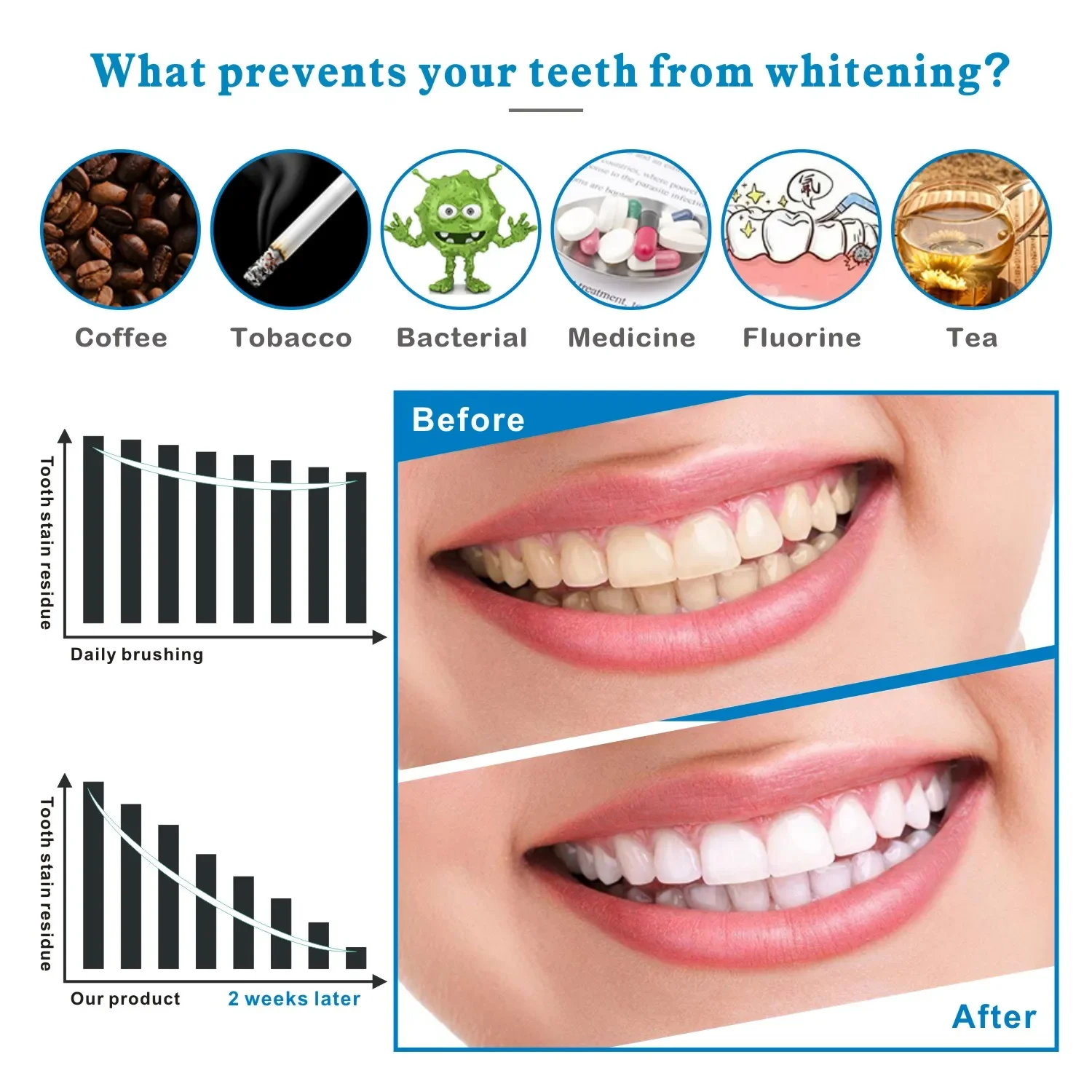 14/28pcs 3D Teeth Whitening St - Teeth Whitening Effects recensione e prezzo