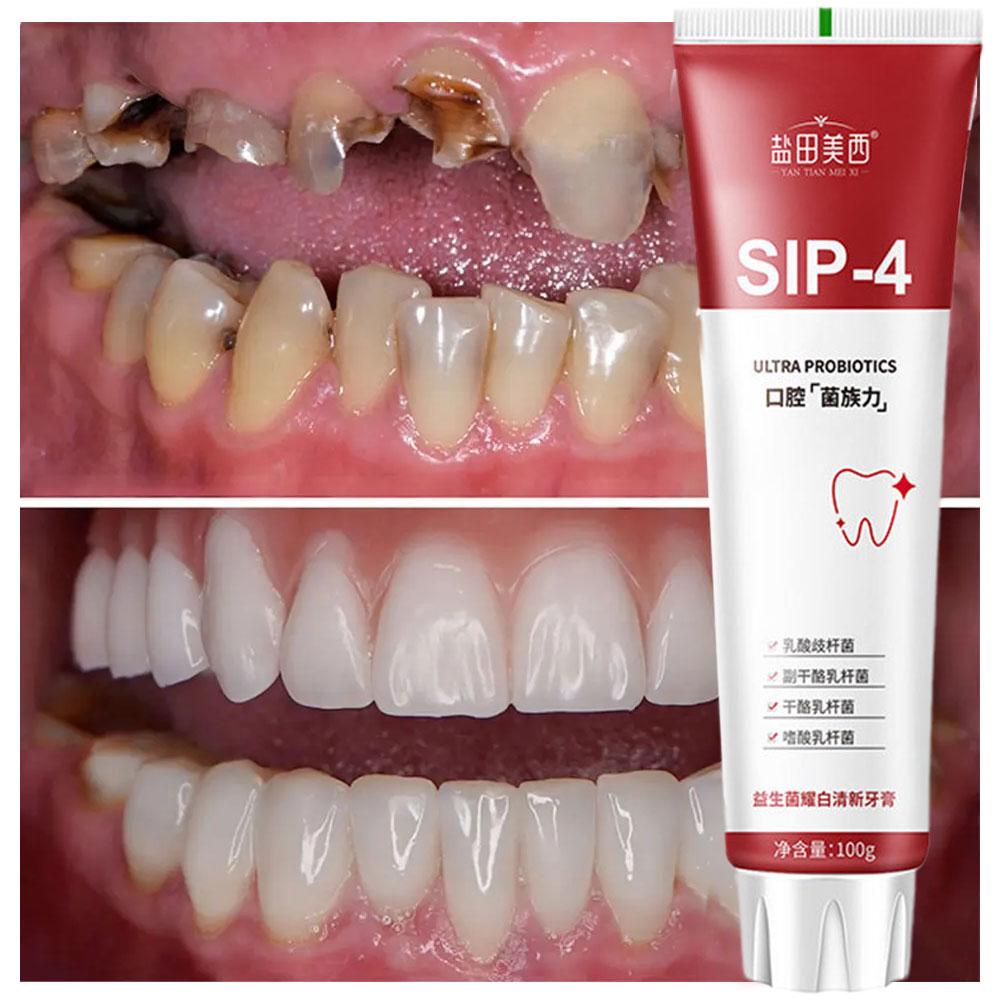 100g Sip-4 Probiotic Whitening - Teeth Whitening Yellow Teeth recensione e prezzo