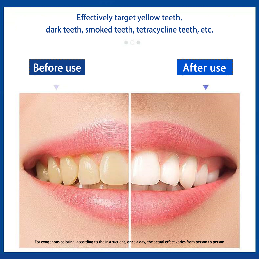 70/140 Pairs 5D White Teeth Wh - Teeth Whitening Effects recensione e prezzo