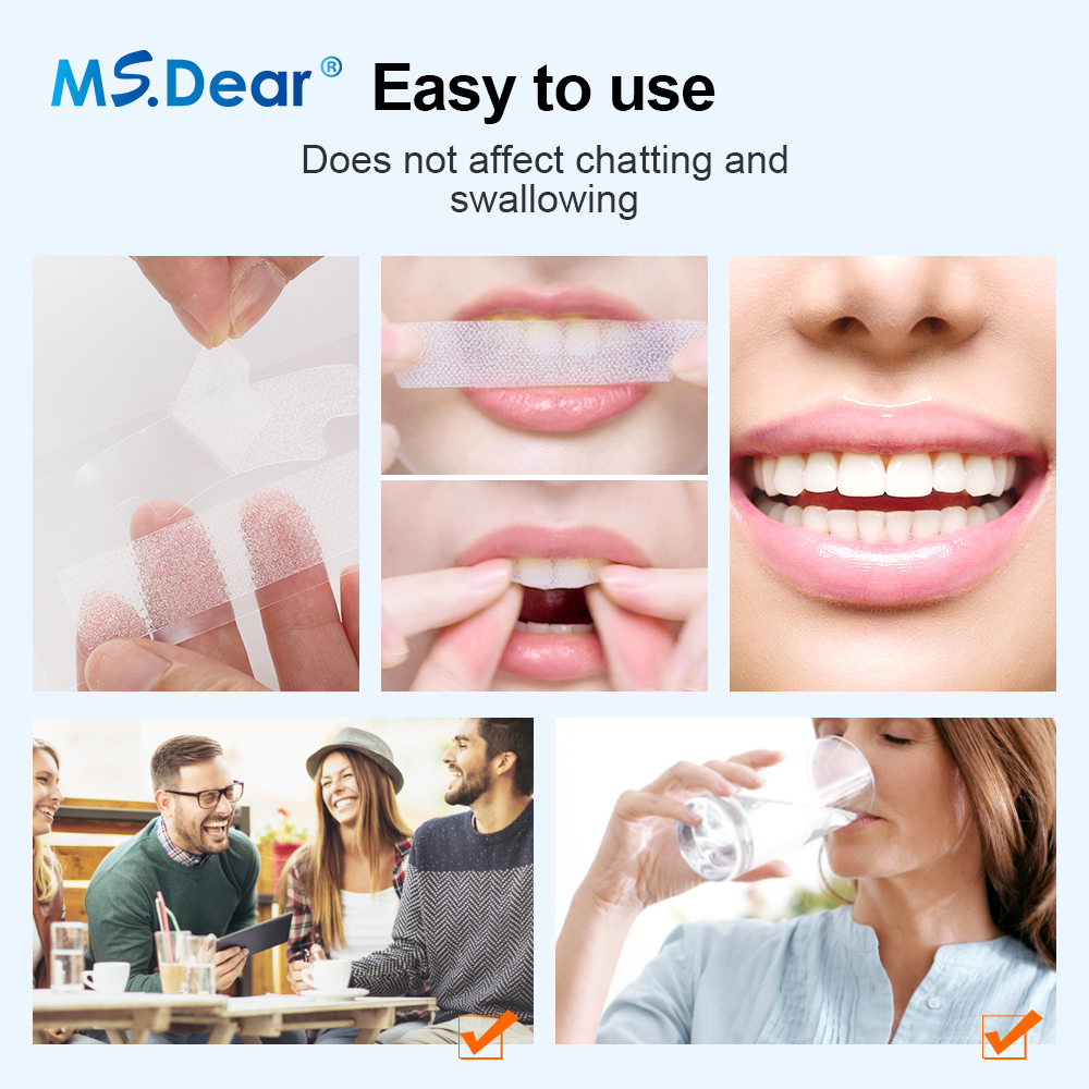 Teeth Whitening Strips Cleansi - Colgate Whitening Teeth recensione e prezzo